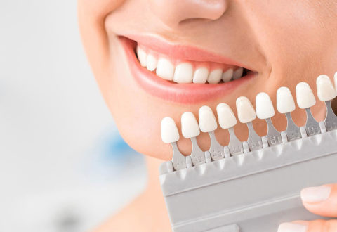 Teeth Whitening Istanbul