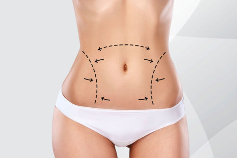 Liposuction in istanbul