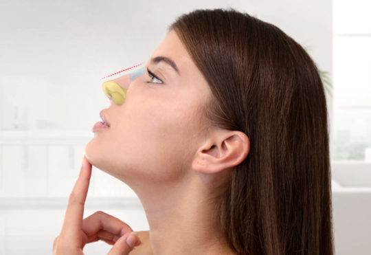 Rhinoplasty in istanbul Rhinoplasty in istanbul