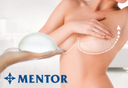 Mentor Implants Mentor Implants