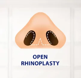 Open Rhinoplasty Open Rhinoplasty