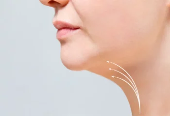 Chin Liposuction Chin Liposuction