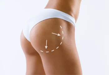 Liposuction Buttocks Liposuction Buttocks