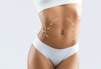 Liposuction Stomach Liposuction Stomach