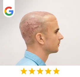 Yorick Saussus-Comment