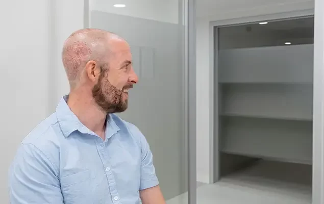 hair-and-beard-transplantation