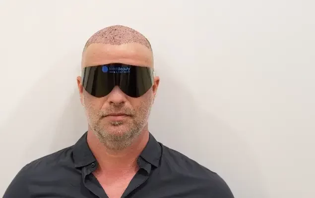 hair-transplantation-and-laser-eye-treatment