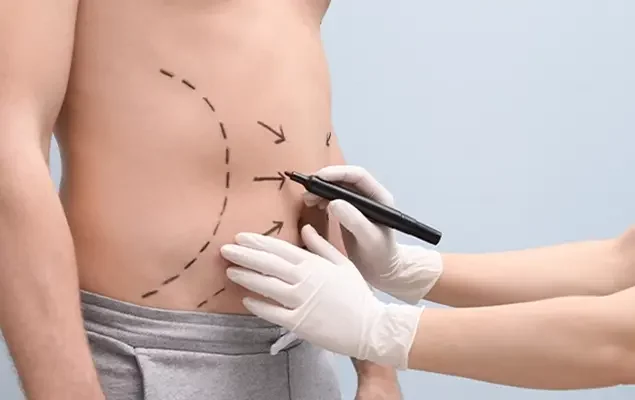 hair-transplantation-and-liposuction